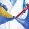 Doctor holding pancreas 3d model and lab vial of blood