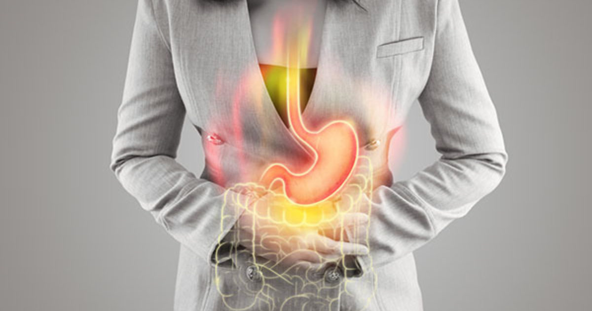 GERD Facts: What You Should Know | GI Associates