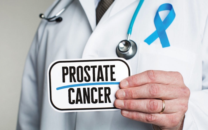 Ibd prostate cancer