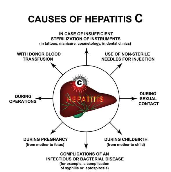 C symptoms hepatitis Hepatitis C
